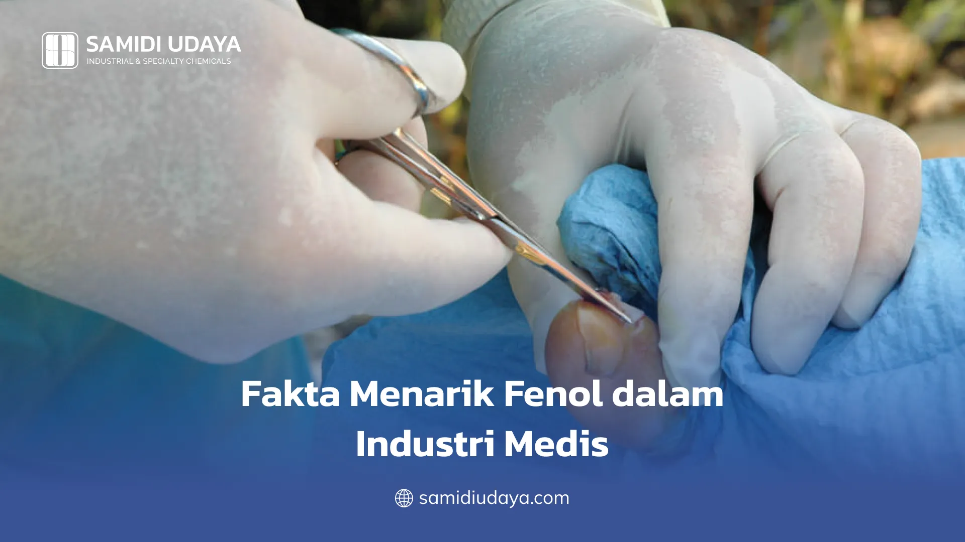 Fakta Menarik Fenol dalam Industri Medis